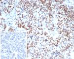 MEIS2 (Transcription Factor) Monoclonal Antibody (PCRP-MEIS2-2B3)