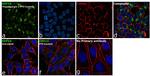 GDF15 Polyclonal Antibody