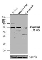 Pannexin 2 Antibody in Western Blot (WB)