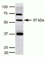 KLF5 Antibody in Western Blot (WB)