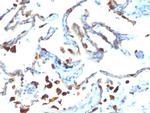 Milk Fat Globule (Breast Epithelial Marker) Antibody in Immunohistochemistry (Paraffin) (IHC (P))