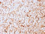 Mammaglobin (SCGB2A2) (Breast Cancer Marker) Monoclonal Antibody (SPM518)
