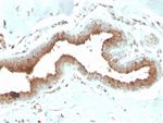 Mammaglobin (SCGB2A2) (Breast Cancer Marker) Monoclonal Antibody (MGB/2704)