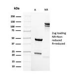 Mammaglobin (SCGB2A2) (Breast Cancer Marker) Antibody in SDS-PAGE (SDS-PAGE)