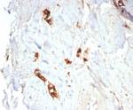 Mammaglobin (SCGB2A2) (Breast Cancer Marker) Recombinant Rabbit Monoclonal Antibody (MGB/7980R)