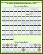 Mammaglobin (SCGB2A2) (Breast Cancer Marker) Recombinant Rabbit Monoclonal Antibody (MSVA-457R)