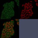 Mammaglobin (SCGB2A2) (Breast Cancer Marker) Recombinant Rabbit Monoclonal Antibody (MGB/2682R)