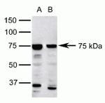 FOXP1 Antibody in Western Blot (WB)