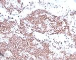 MGMT (Marker of Suppressor of Mutation and Carcinogenesis) Monoclonal Antibody (MGMT/4791)