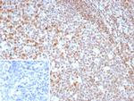 MGMT (Marker of Suppressor of Mutation and Carcinogenesis) Recombinant Rabbit Monoclonal Antibody (MGMT/8319R)