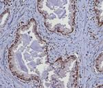 MGMT (Marker of Suppressor of Mutation and Carcinogenesis) Antibody in Immunohistochemistry (Paraffin) (IHC (P))