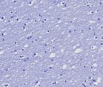 MGMT (Marker of Suppressor of Mutation and Carcinogenesis) Antibody in Immunohistochemistry (Paraffin) (IHC (P))