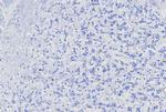 MGMT (Marker of Suppressor of Mutation and Carcinogenesis) Recombinant Rabbit Monoclonal Antibody (MGMT/8128R)