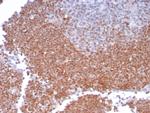 MGMT (Marker of Suppressor of Mutation and Carcinogenesis) Recombinant Rabbit Monoclonal Antibody (MGMT/8186R)