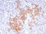 CD99/MIC2 (Ewing's Sarcoma Marker) Antibody in Immunohistochemistry (Paraffin) (IHC (P))