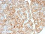 CD99/MIC2 (Ewing's Sarcoma Marker) Antibody in Immunohistochemistry (Paraffin) (IHC (P))