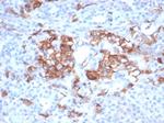 CD99/MIC2 (Ewing's Sarcoma Marker) Antibody in Immunohistochemistry (Paraffin) (IHC (P))