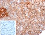 CD99/MIC2 (Ewing's Sarcoma Marker) Antibody in Immunohistochemistry (Paraffin) (IHC (P))