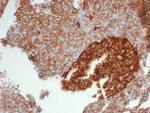 CD99/MIC2 (Ewing's Sarcoma Marker) Antibody in Immunohistochemistry (Paraffin) (IHC (P))