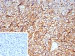 CD99/MIC2 (Ewing's Sarcoma Marker) Antibody in Immunohistochemistry (Paraffin) (IHC (P))