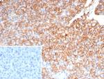 CD99/MIC2 (Ewing's Sarcoma Marker) Antibody in Immunohistochemistry (Paraffin) (IHC (P))