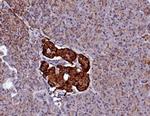 CD99/MIC2 (Ewing's Sarcoma Marker) Antibody in Immunohistochemistry (Paraffin) (IHC (P))