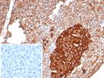 CD99/MIC2 (Ewing's Sarcoma Marker) Antibody in Immunohistochemistry (Paraffin) (IHC (P))