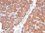 CD99/MIC2 (Ewing's Sarcoma Marker) Monoclonal Antibody (MIC2/7865)