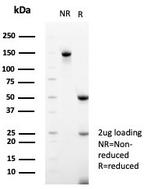 CD99/MIC2 (Ewing's Sarcoma Marker) Antibody in SDS-PAGE (SDS-PAGE)