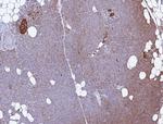 CD99/MIC2 (Ewing's Sarcoma Marker) Monoclonal Antibody (MIC2/7866)