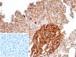 CD99/MIC2 (Ewing's Sarcoma Marker) Antibody in Immunohistochemistry (Paraffin) (IHC (P))