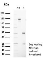 CD99/MIC2 (Ewing's Sarcoma Marker) Antibody in SDS-PAGE (SDS-PAGE)