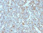 CD99/MIC2 Antibody in Immunohistochemistry (Paraffin) (IHC (P))