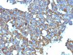 CD99/MIC2 Antibody in Immunohistochemistry (Paraffin) (IHC (P))