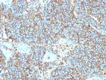 CD99/MIC2 (Ewing's Sarcoma Marker) Antibody in Immunohistochemistry (Paraffin) (IHC (P))