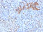 CD99/MIC2 (Ewing's Sarcoma Marker) Antibody in Immunohistochemistry (Paraffin) (IHC (P))