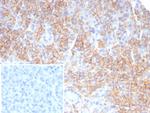 CD99/MIC2 (Ewing's Sarcoma Marker) Antibody in Immunohistochemistry (Paraffin) (IHC (P))