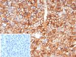 CD99/MIC2 (Ewing's Sarcoma Marker) Recombinant Rabbit Monoclonal Antibody (MIC2/8119R)