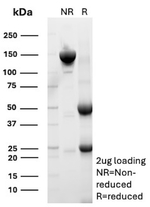CD99/MIC2 (Ewing's Sarcoma Marker) Antibody in SDS-PAGE (SDS-PAGE)