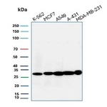 CD99/MIC2 (Ewing's Sarcoma Marker) Antibody in Western Blot (WB)