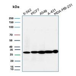 CD99/MIC2 (Ewing's Sarcoma Marker) Antibody in Western Blot (WB)