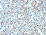 CD99/MIC2 (Ewing's Sarcoma Marker) Antibody in Immunohistochemistry (Paraffin) (IHC (P))