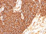 CD99/MIC2 Antibody in Immunohistochemistry (Paraffin) (IHC (P))