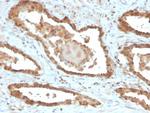 MIF (Macrophage Migration Inhibitory Factor) Monoclonal Antibody (MIF/6277)