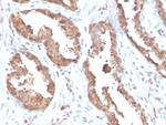 MIF (Macrophage Migration Inhibitory Factor) Monoclonal Antibody (MIF/6278)