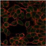 Microphthalmia Transcription Factor (MITF) Monoclonal Antibody (PCRP-MITF-1D9)