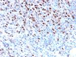 Microphthalmia Transcription Factor (MITF) Recombinant Rabbit Monoclonal Antibody (MITF/2987R)