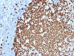 Ki-67 Antibody in Immunohistochemistry (Paraffin) (IHC (P))