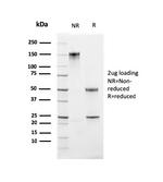 Ki-67 Antibody in SDS-PAGE (SDS-PAGE)