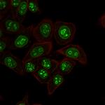 Ki-67 Antibody in Immunocytochemistry (ICC/IF)
